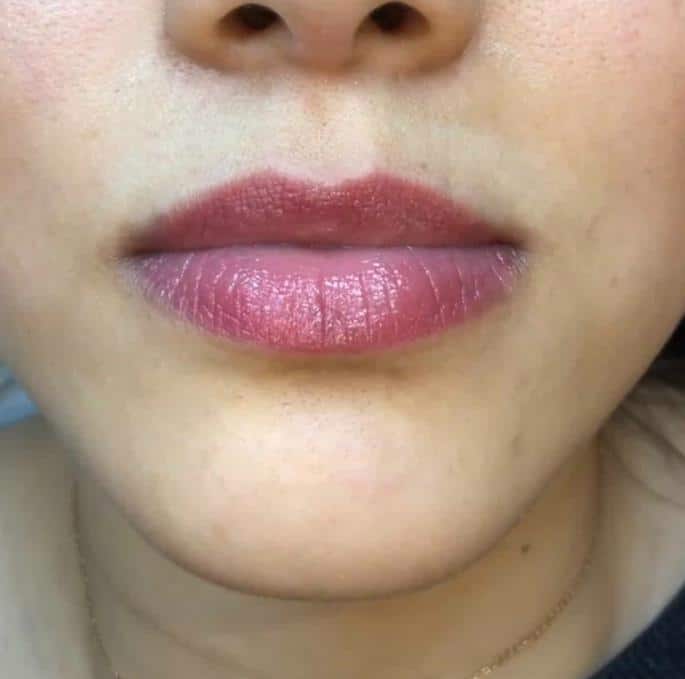 A woman after getting a permanent lip blush treatment.