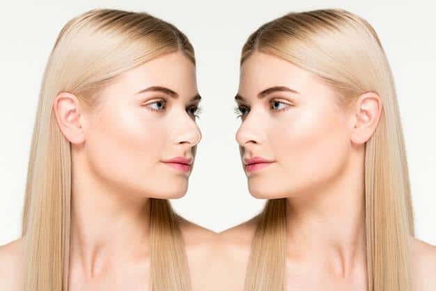 Before and after results of Kybella jawline contouring treatment