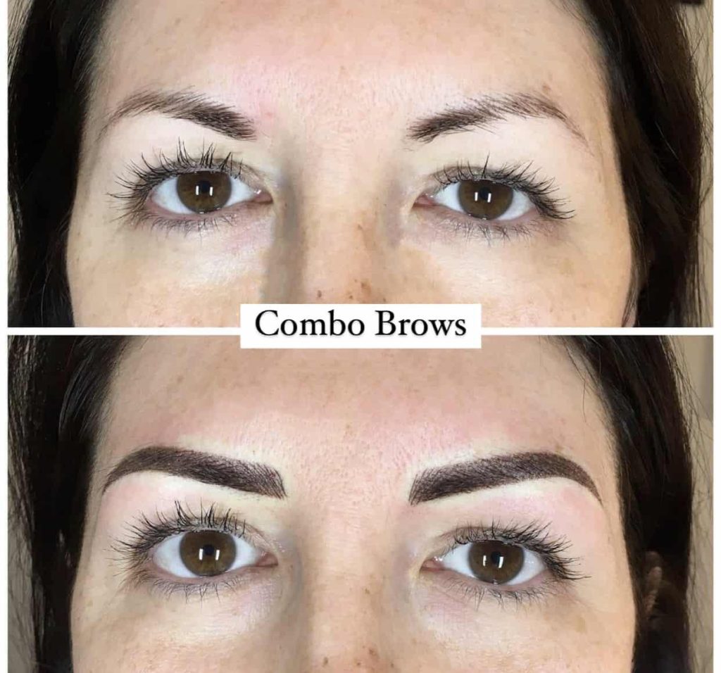 Before and after digital brow mapping results.