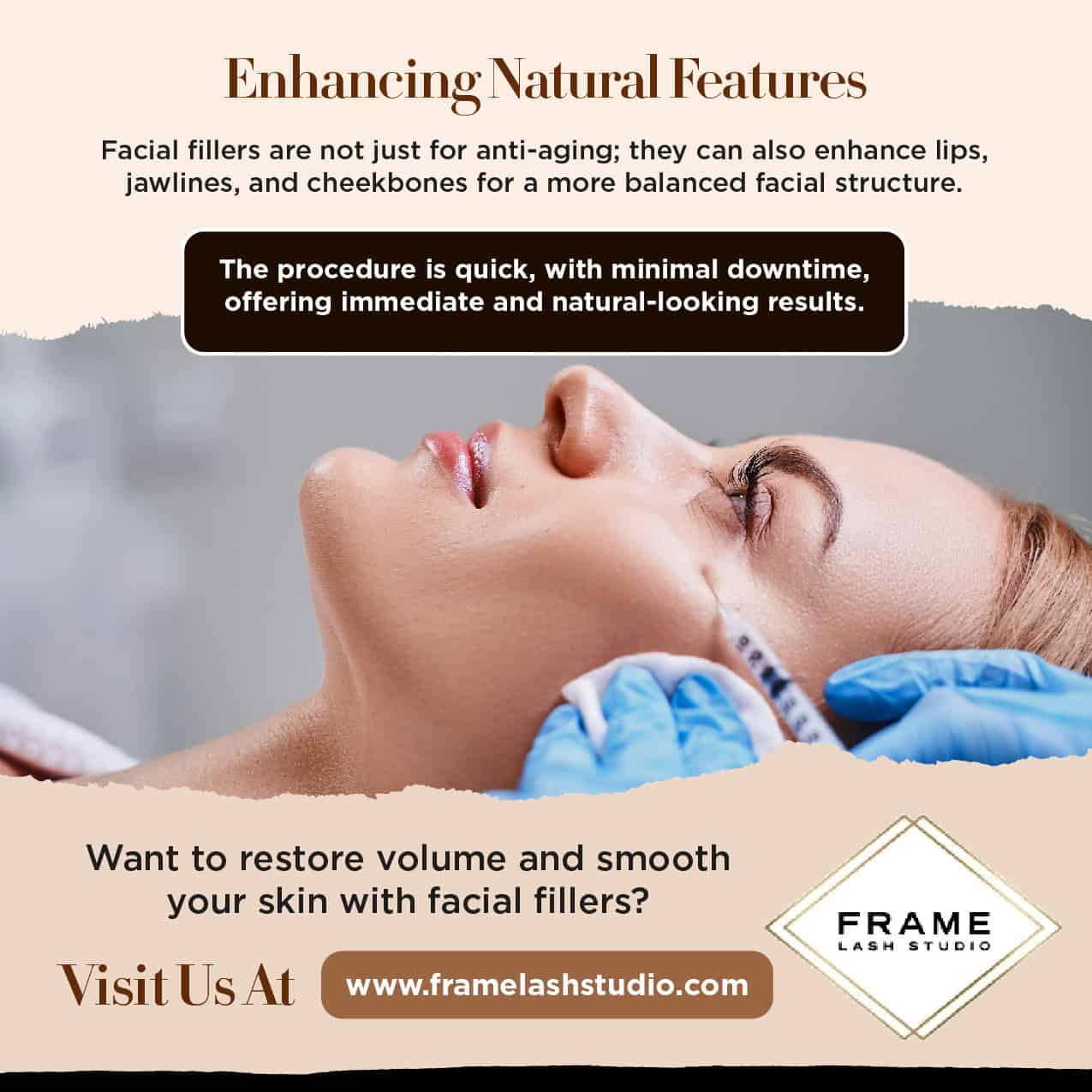 Enhancing Natural Features with Facial Fillers