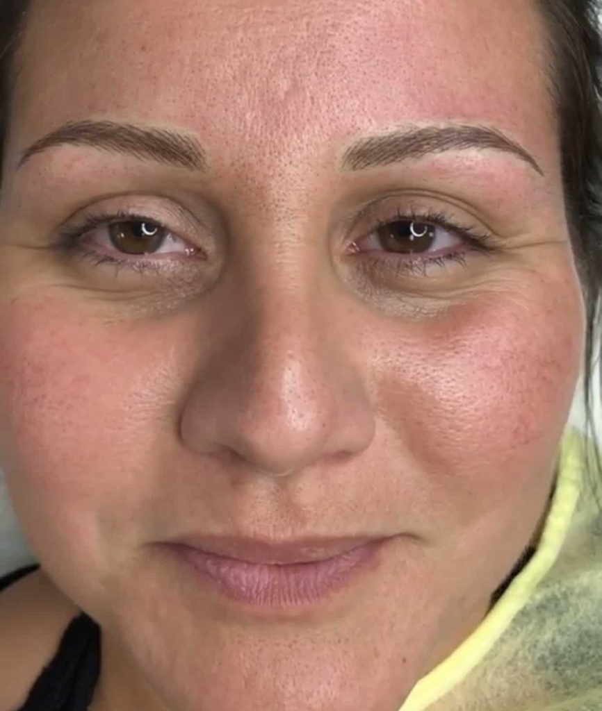 results of microblading and nano brows oakville